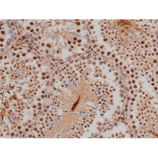 SP1 Antibody - 1:200 staining mouse testis tissue by IHC-P. The tissue was formaldehyde fixed and a heat mediated antigen retrieval step in citrate buffer was performed. The tissue was then blocked and incubated with the antibody for 1.5 hours at 22°C. An HRP conjugated goat anti-rabbit antibody was used as the secondary.