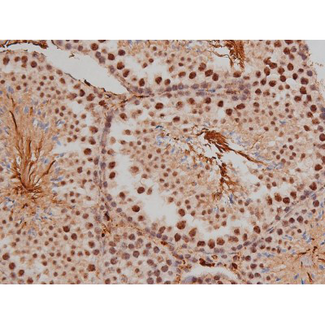 SP1 Antibody - 1:200 staining mouse testis tissue by IHC-P. The tissue was formaldehyde fixed and a heat mediated antigen retrieval step in citrate buffer was performed. The tissue was then blocked and incubated with the antibody for 1.5 hours at 22°C. An HRP conjugated goat anti-rabbit antibody was used as the secondary.