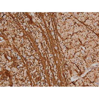 SP1 Antibody - 1:200 staining rat brain tissue by IHC-P. The tissue was formaldehyde fixed and a heat mediated antigen retrieval step in citrate buffer was performed. The tissue was then blocked and incubated with the antibody for 1.5 hours at 22°C. An HRP conjugated goat anti-rabbit antibody was used as the secondary.