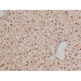SP1 Antibody - 1:200 staining rat liver tissue by IHC-P. The tissue was formaldehyde fixed and a heat mediated antigen retrieval step in citrate buffer was performed. The tissue was then blocked and incubated with the antibody for 1.5 hours at 22°C. An HRP conjugated goat anti-rabbit antibody was used as the secondary.