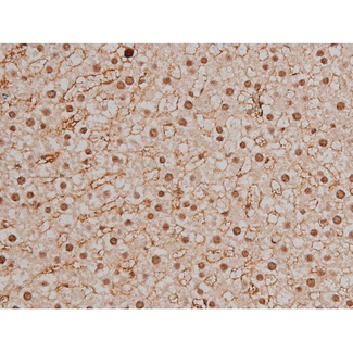 SP1 Antibody - 1:200 staining rat liver tissue by IHC-P. The tissue was formaldehyde fixed and a heat mediated antigen retrieval step in citrate buffer was performed. The tissue was then blocked and incubated with the antibody for 1.5 hours at 22°C. An HRP conjugated goat anti-rabbit antibody was used as the secondary.