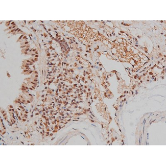 SP1 Antibody - 1:200 staining rat lung tissue by IHC-P. The tissue was formaldehyde fixed and a heat mediated antigen retrieval step in citrate buffer was performed. The tissue was then blocked and incubated with the antibody for 1.5 hours at 22°C. An HRP conjugated goat anti-rabbit antibody was used as the secondary.