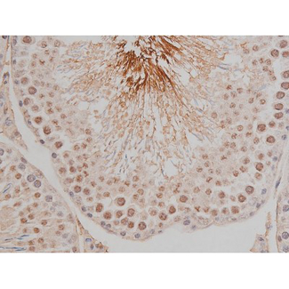 SP1 Antibody - 1:200 staining rat testis tissue by IHC-P. The tissue was formaldehyde fixed and a heat mediated antigen retrieval step in citrate buffer was performed. The tissue was then blocked and incubated with the antibody for 1.5 hours at 22°C. An HRP conjugated goat anti-rabbit antibody was used as the secondary.