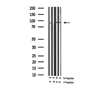 SP1 Antibody - Western blot analysis of Phospho-SP1 (Thr739) expression in various lysates