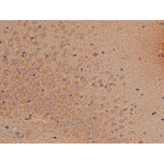 SP1 Antibody - 1:200 staining mouse brain tissue by IHC-P. The tissue was formaldehyde fixed and a heat mediated antigen retrieval step in citrate buffer was performed. The tissue was then blocked and incubated with the antibody for 1.5 hours at 22°C. An HRP conjugated goat anti-rabbit antibody was used as the secondary.