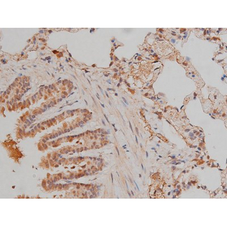 SP1 Antibody - 1:200 staining rat lung tissue by IHC-P. The tissue was formaldehyde fixed and a heat mediated antigen retrieval step in citrate buffer was performed. The tissue was then blocked and incubated with the antibody for 1.5 hours at 22°C. An HRP conjugated goat anti-rabbit antibody was used as the secondary.
