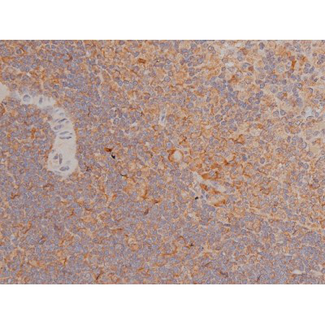 SP1 Antibody - 1:200 staining rat spleen tissue by IHC-P. The tissue was formaldehyde fixed and a heat mediated antigen retrieval step in citrate buffer was performed. The tissue was then blocked and incubated with the antibody for 1.5 hours at 22°C. An HRP conjugated goat anti-rabbit antibody was used as the secondary.