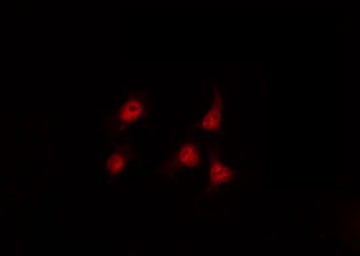 SP1 Antibody - Staining A549 cells by IF/ICC. The samples were fixed with PFA and permeabilized in 0.1% Triton X-100, then blocked in 10% serum for 45 min at 25°C. The primary antibody was diluted at 1:200 and incubated with the sample for 1 hour at 37°C. An Alexa Fluor 594 conjugated goat anti-rabbit IgG (H+L) Ab, diluted at 1/600, was used as the secondary antibody.