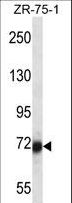 SP100 Antibody - SP100 Antibody western blot of ZR-75-1 cell line lysates (35 ug/lane). The SP100 antibody detected the SP100 protein (arrow).