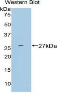 SP100 Antibody - Western blot of recombinant SP100.  This image was taken for the unconjugated form of this product. Other forms have not been tested.