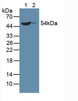 SP100 Antibody - Western Blot; Sample: Lane1: Human Hela Cells; Lane2: Human MCF-7 Cells.