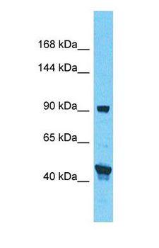 SP100 Antibody - Western blot of SP100 Antibody with human 721_B Whole Cell lysate.  This image was taken for the unconjugated form of this product. Other forms have not been tested.