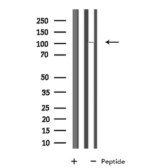 SP100 Antibody - Western blot analysis of extracts of HT29 cells using SP100 antibody.