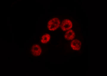 SP100 Antibody - Staining HeLa cells by IF/ICC. The samples were fixed with PFA and permeabilized in 0.1% Triton X-100, then blocked in 10% serum for 45 min at 25°C. The primary antibody was diluted at 1:200 and incubated with the sample for 1 hour at 37°C. An Alexa Fluor 594 conjugated goat anti-rabbit IgG (H+L) Ab, diluted at 1/600, was used as the secondary antibody.