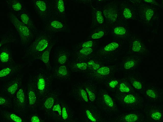 SP100 Antibody - Immunofluorescence staining of SP100 in U2OS cells. Cells were fixed with 4% PFA, permeabilzed with 0.1% Triton X-100 in PBS, blocked with 10% serum, and incubated with rabbit anti-Human SP100 polyclonal antibody (dilution ratio 1:200) at 4°C overnight. Then cells were stained with the Alexa Fluor 488-conjugated Goat Anti-rabbit IgG secondary antibody (green). Positive staining was localized to Nucleus.