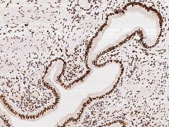 SP100 Antibody - Immunochemical staining of human SP100 in human gallbladder with rabbit polyclonal antibody at 1:500 dilution, formalin-fixed paraffin embedded sections.