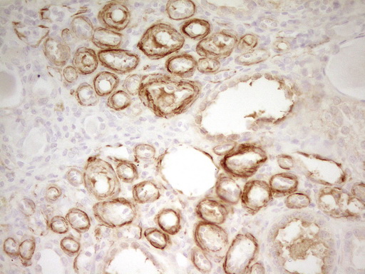 SP110 Antibody - Immunohistochemical staining of paraffin-embedded Human Kidney tissue within the normal limits using anti-SP110 mouse monoclonal antibody. (Heat-induced epitope retrieval by 1 mM EDTA in 10mM Tris, pH8.5, 120C for 3min,