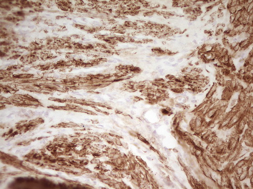 SP110 Antibody - IHC of paraffin-embedded Human endometrium tissue using anti-SP110 mouse monoclonal antibody. (Heat-induced epitope retrieval by 1 mM EDTA in 10mM Tris, pH8.5, 120°C for 3min).