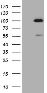 SP110 Antibody - HEK293T cells were transfected with the pCMV6-ENTRY control. (Left lane) or pCMV6-ENTRY. (Right lane) cDNA for 48 hrs and lysed. Equivalent amounts of cell lysates. (5 ug per lane) were separated by SDS-PAGE and immunoblotted with anti-SP110. (1:2000)