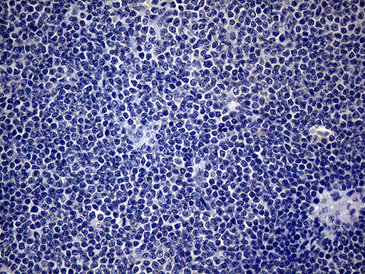 SP110 Antibody - Immunohistochemical staining of paraffin-embedded Human lymphoma tissue using anti-SP110 mouse monoclonal antibody.This figure shows negative staining. (Heat-induced epitope retrieval by 1mM EDTA in 10mM Tris buffer. (pH8.5) at 120°C for 3 min. (1:150)