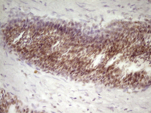 SP110 Antibody - Immunohistochemical staining of paraffin-embedded Human prostate tissue within the normal limits using anti-SP110 mouse monoclonal antibody. (Heat-induced epitope retrieval by 1 mM EDTA in 10mM Tris, pH8.5, 120C for 3min,