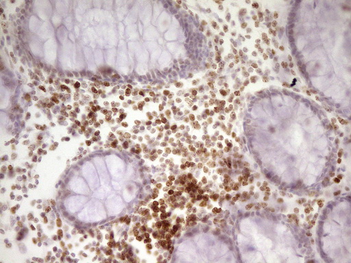 SP110 Antibody - Immunohistochemical staining of paraffin-embedded Human colon tissue within the normal limits using anti-SP110 mouse monoclonal antibody. (Heat-induced epitope retrieval by 1 mM EDTA in 10mM Tris, pH8.5, 120C for 3min,