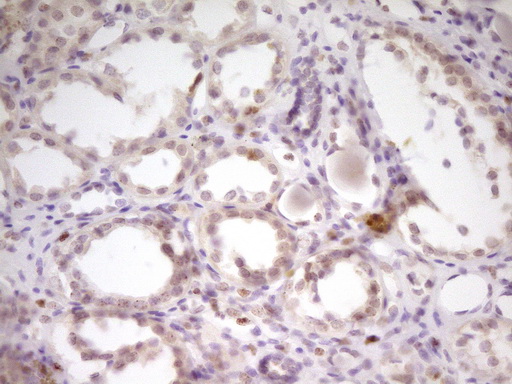 SP110 Antibody - Immunohistochemical staining of paraffin-embedded Human Kidney tissue within the normal limits using anti-SP110 mouse monoclonal antibody. (Heat-induced epitope retrieval by 1 mM EDTA in 10mM Tris, pH8.5, 120C for 3min,