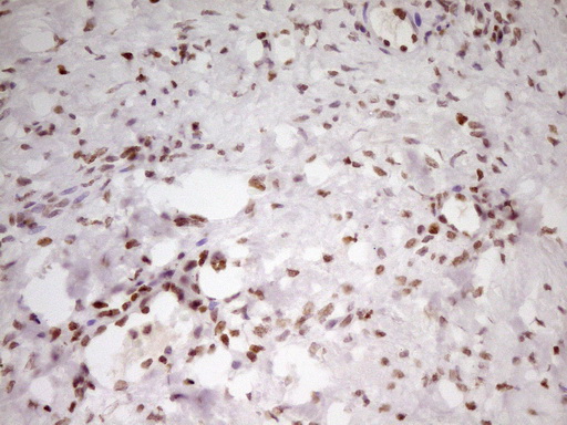 SP110 Antibody - Immunohistochemical staining of paraffin-embedded Human Ovary tissue within the normal limits using anti-SP110 mouse monoclonal antibody. (Heat-induced epitope retrieval by 1 mM EDTA in 10mM Tris, pH8.5, 120C for 3min,