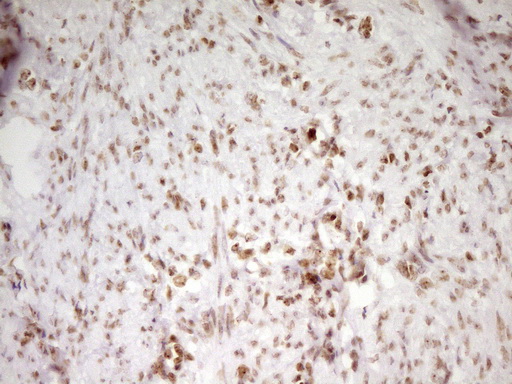 SP110 Antibody - Immunohistochemical staining of paraffin-embedded Human endometrium tissue within the normal limits using anti-SP110 mouse monoclonal antibody. (Heat-induced epitope retrieval by 1 mM EDTA in 10mM Tris, pH8.5, 120C for 3min,