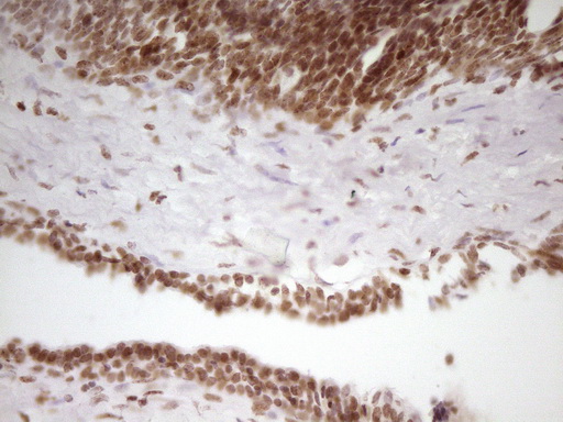 SP110 Antibody - Immunohistochemical staining of paraffin-embedded Human prostate tissue within the normal limits using anti-SP110 mouse monoclonal antibody. (Heat-induced epitope retrieval by 1 mM EDTA in 10mM Tris, pH8.5, 120C for 3min,
