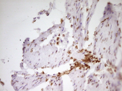 SP110 Antibody - Immunohistochemical staining of paraffin-embedded Human bladder tissue within the normal limits using anti-SP110 mouse monoclonal antibody. (Heat-induced epitope retrieval by 1 mM EDTA in 10mM Tris, pH8.5, 120C for 3min,