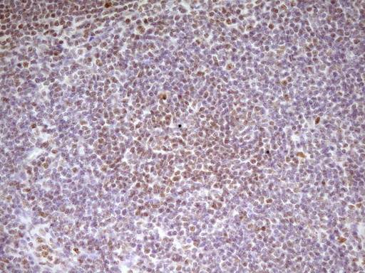 SP110 Antibody - Immunohistochemical staining of paraffin-embedded Human lymph node tissue within the normal limits using anti-SP110 mouse monoclonal antibody. (Heat-induced epitope retrieval by 1 mM EDTA in 10mM Tris, pH8.5, 120C for 3min,
