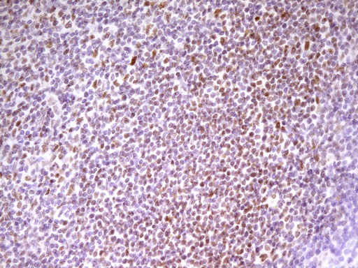 SP110 Antibody - Immunohistochemical staining of paraffin-embedded Human tonsil within the normal limits using anti-SP110 mouse monoclonal antibody. (Heat-induced epitope retrieval by 1 mM EDTA in 10mM Tris, pH8.5, 120C for 3min,