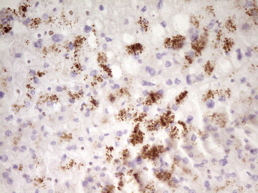 SP110 Antibody - Immunohistochemical staining of paraffin-embedded Human liver tissue within the normal limits using anti-SP110 mouse monoclonal antibody. (Heat-induced epitope retrieval by 1 mM EDTA in 10mM Tris, pH8.5, 120C for 3min,