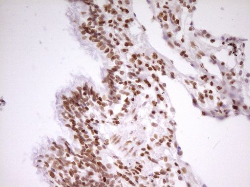 SP110 Antibody - Immunohistochemical staining of paraffin-embedded Human lung tissue within the normal limits using anti-SP110 mouse monoclonal antibody. (Heat-induced epitope retrieval by 1 mM EDTA in 10mM Tris, pH8.5, 120C for 3min,
