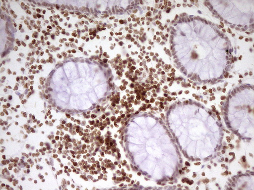 SP110 Antibody - IHC of paraffin-embedded Human colon tissue using anti-SP110 mouse monoclonal antibody. (Heat-induced epitope retrieval by 1 mM EDTA in 10mM Tris, pH8.5, 120°C for 3min).