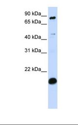 SP110 Antibody - MCF7 cell lysate. Antibody concentration: 1.0 ug/ml. Gel concentration: 12%.  This image was taken for the unconjugated form of this product. Other forms have not been tested.