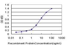 SP110 Antibody - Detection limit for recombinant GST tagged SP110 is approximately 0.1 ng/ml as a capture antibody.