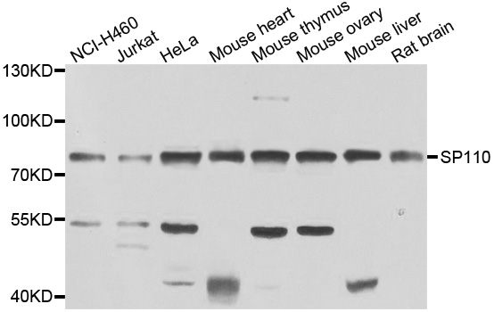 SP110 Antibody - Western blot analysis of extracts of various cell lines.