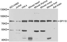 SP110 Antibody - Western blot analysis of extracts of various cell lines.