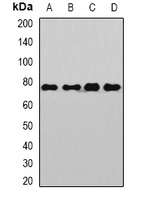 SP110 Antibody - Western blot analysis of Sp110 expression in Jurkat (A); HeLa (B); mouse liver (C); rat brain (D) whole cell lysates.