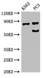 SP110 Antibody - Positive WB detected in:K562 whole cell lysate,PC3 whole cell lysate;All lanes:SP110 antibody at 2.7?g/ml;Secondary;Goat polyclonal to rabbit IgG at 1/50000 dilution;Predicted band size: 79,47,62,29,82,63 KDa;Observed band size: 79,64 KDa;