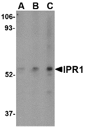 SP110 Antibody - Western blot of IPR1 in HeLa cell lysate with IPR1 antibody at (A) 0.5, (B) 1, and (C) 2 ug/ml.