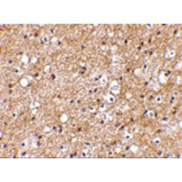 SP110 Antibody - Immunohistochemical staining of human brain tissue using IPR1 antibody at 2.5 µg/mL.