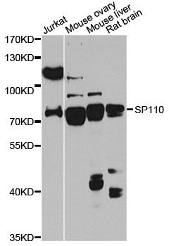 SP110 Antibody - Western blot analysis of extracts of various cell lines, using SP110 antibody at 1:1000 dilution. The secondary antibody used was an HRP Goat Anti-Rabbit IgG (H+L) at 1:10000 dilution. Lysates were loaded 25ug per lane and 3% nonfat dry milk in TBST was used for blocking. An ECL Kit was used for detection and the exposure time was 90s.