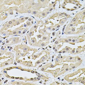 SP110 Antibody - Immunohistochemistry of paraffin-embedded Human kidney using SP110 Polyclonal Antibody at dilution of 1:100 (40x lens).