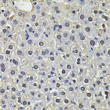 SP110 Antibody - Immunohistochemistry of paraffin-embedded Mouse liver using SP110 Polyclonal Antibody at dilution of 1:100 (40x lens).