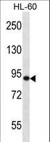 SP140 Antibody - SP140 Antibody western blot of HL-60 cell line lysates (35 ug/lane). The SP140 antibody detected the SP140 protein (arrow).