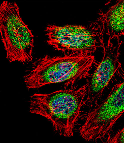 SP140 Antibody - Fluorescent confocal image of HeLa cell stained with SP140 Antibody. HeLa cells were fixed with 4% PFA (20 min), permeabilized with Triton X-100 (0.1%, 10 min), then incubated with SP140 primary antibody (1:25, 1 h at 37°C). For secondary antibody, Alexa Fluor 488 conjugated donkey anti-rabbit antibody (green) was used (1:400, 50 min at 37°C). Cytoplasmic actin was counterstained with Alexa Fluor 555 (red) conjugated Phalloidin (7units/ml, 1 h at 37°C). Nuclei were counterstained with DAPI (blue) (10 ug/ml, 10 min). SP140 immunoreactivity is localized to Cytoplasm and Nucleus significantly.