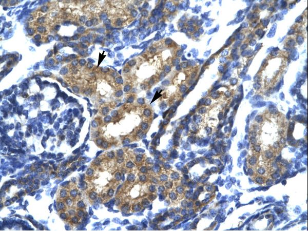 SP140 Antibody - SP140 antibody ARP32854_T100-NP_001005176-SP140 (SP140 nuclear body protein) Antibody was used in IHC to stain formalin-fixed, paraffin-embedded human kidney.  This image was taken for the unconjugated form of this product. Other forms have not been tested.